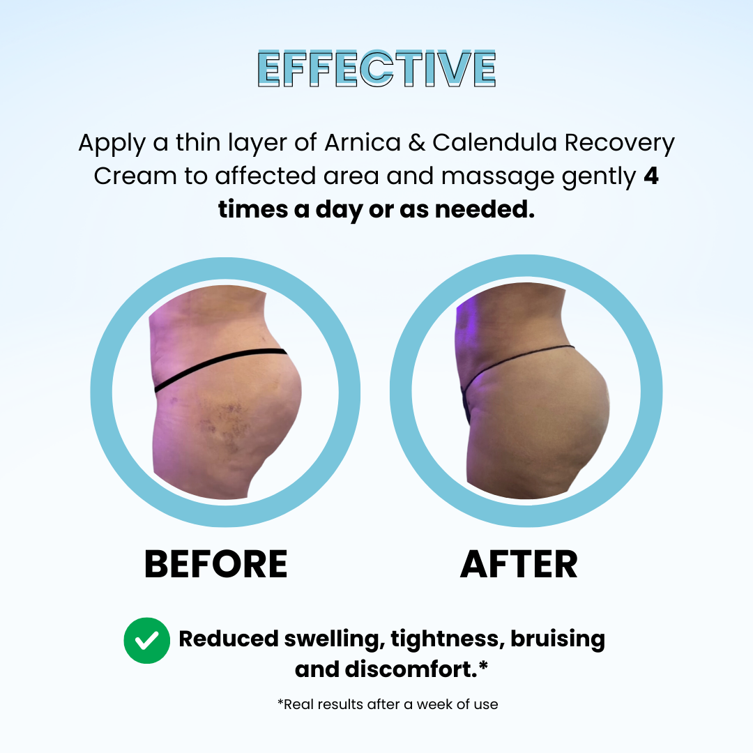 Arnica and Calendula Anti Inflammatory Post Healing Cream
